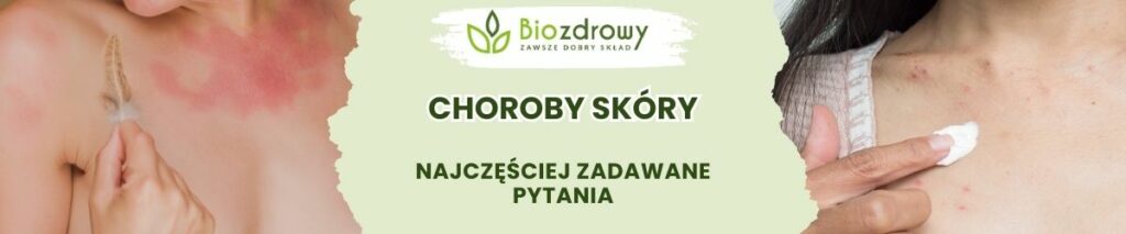 Choroby skóry FAQ - obrazek poglądowy