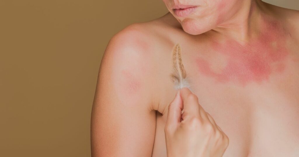 Choroby skóry – jakie są ich objawy i co je wywołuje? - obrazek wyróżniający