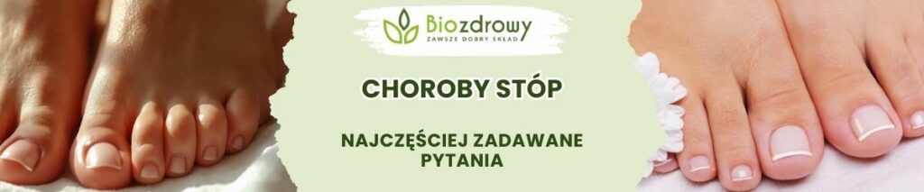 Choroby stóp FAQ - obrazek poglądowy
