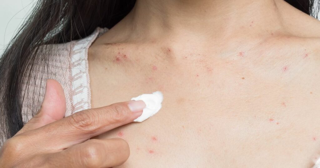 Jak leczyc choroby skóry? - infografika