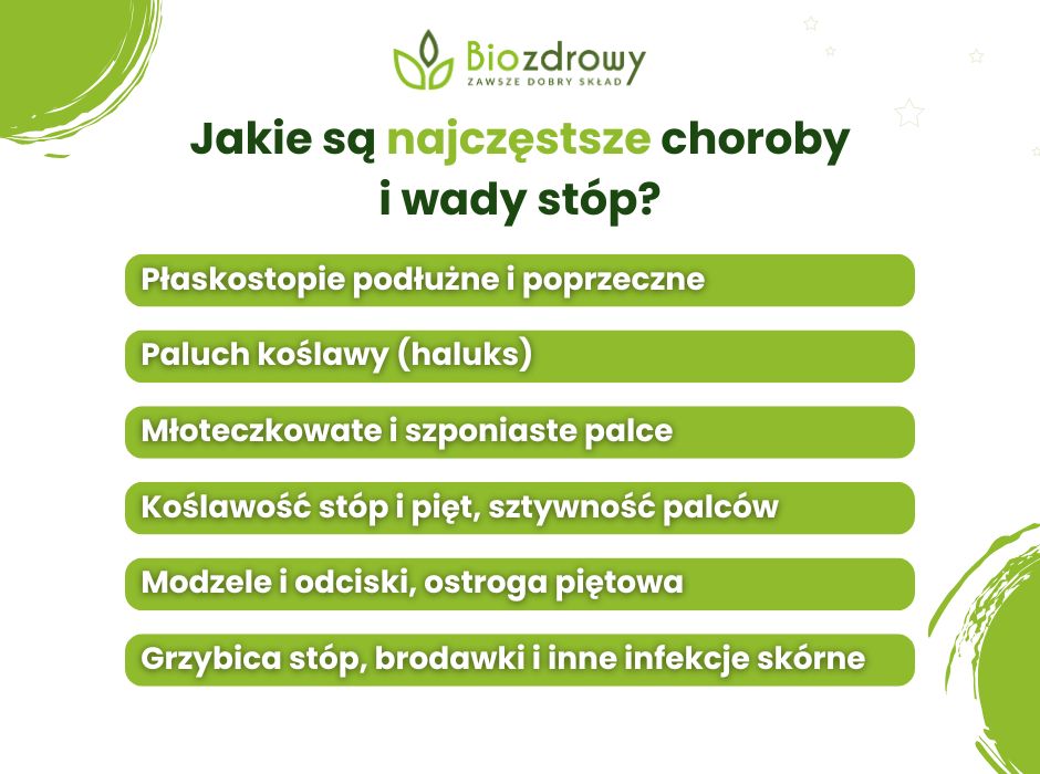 Najczęstsze choroby stóp - infografika
