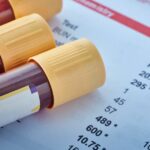 Zakres referencyjny. Jak odczytać i interpretować wyniki badań laboratoryjnych - obrazek wyróżniający