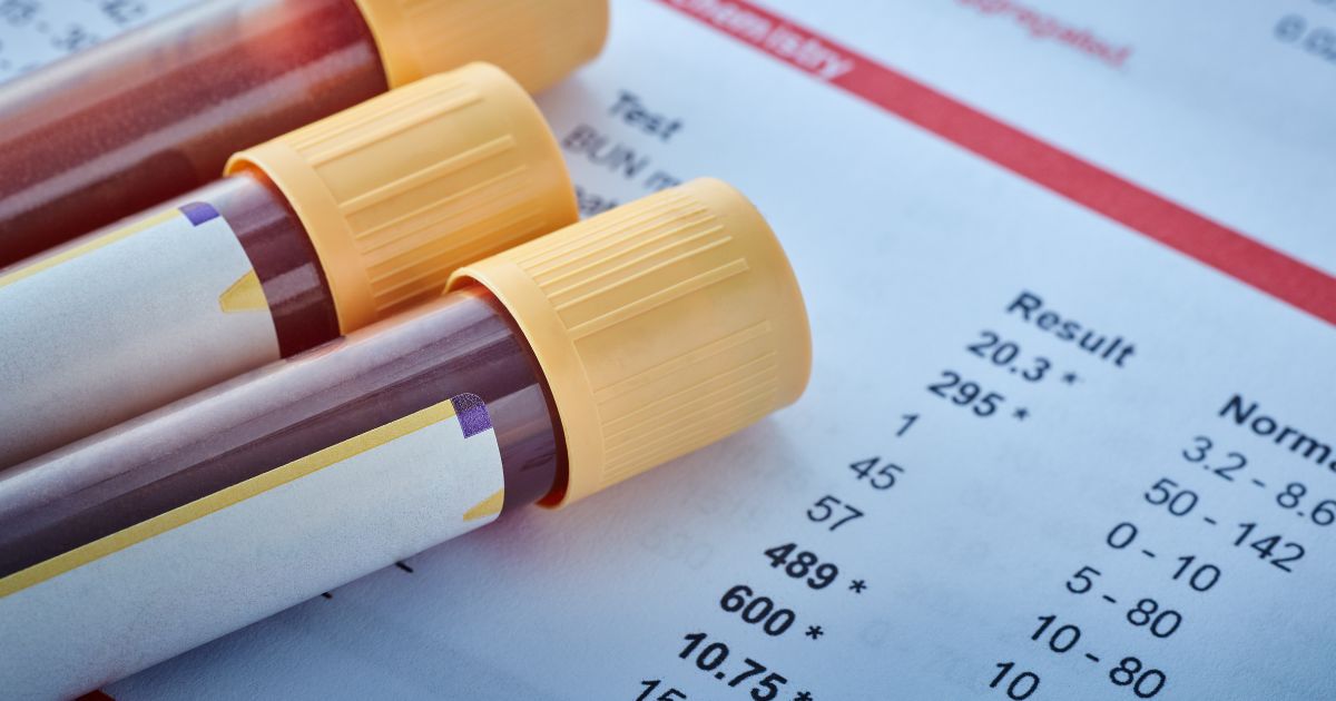 Zakres referencyjny. Jak odczytać i interpretować wyniki badań laboratoryjnych - obrazek wyróżniający