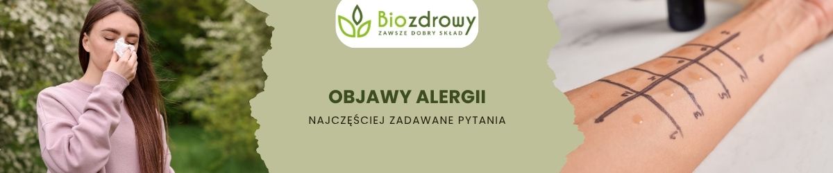 objawy alergii faq - najczęściej zadawane pytania