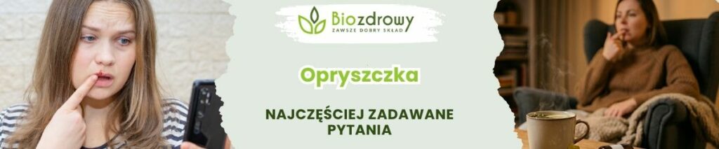 Opryszczka FAQ - obrazek poglądowy