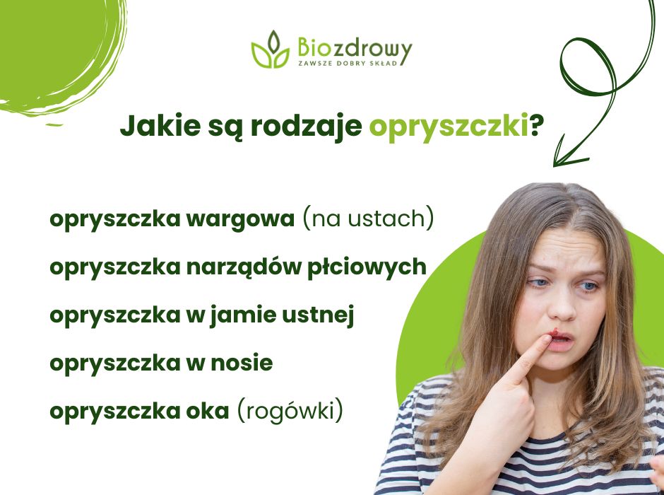 Rodzaje opryszczki - infografika
