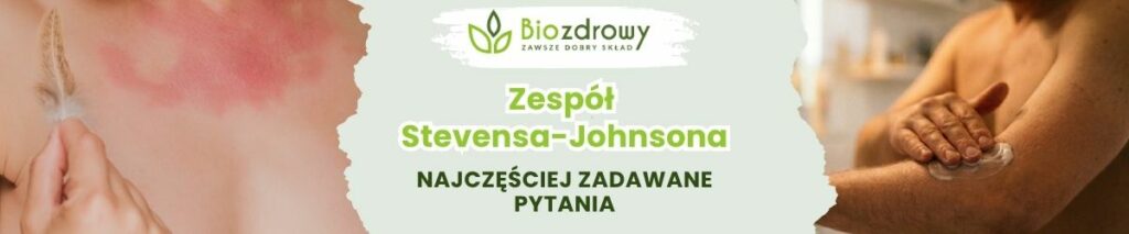 Zespół 
Stevensa-Johnsona FAQ - obrezek poglądowy