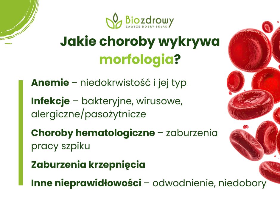Jakie choroby wykrywa morfologia? - infografika