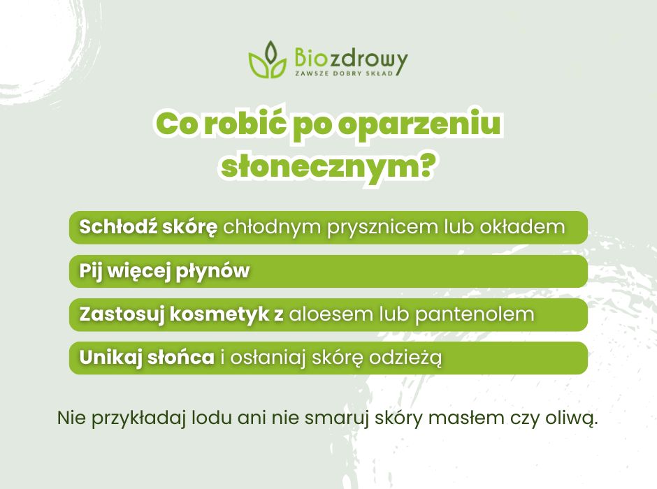 Co robić po oparzeniu słonecznym? - infografika