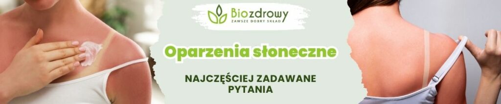 Oparzenia słoneczne FAQ - obrazek poglądowy
